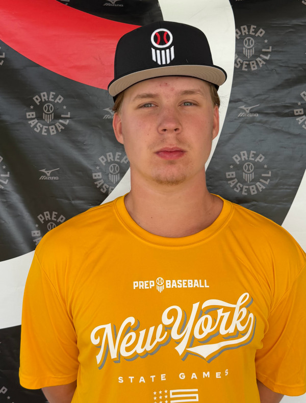 Zach Burtis