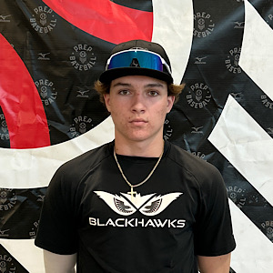 Colten Burleson