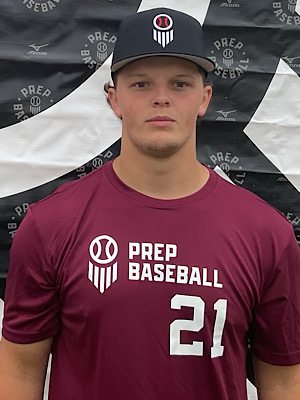 Treydon Hofer